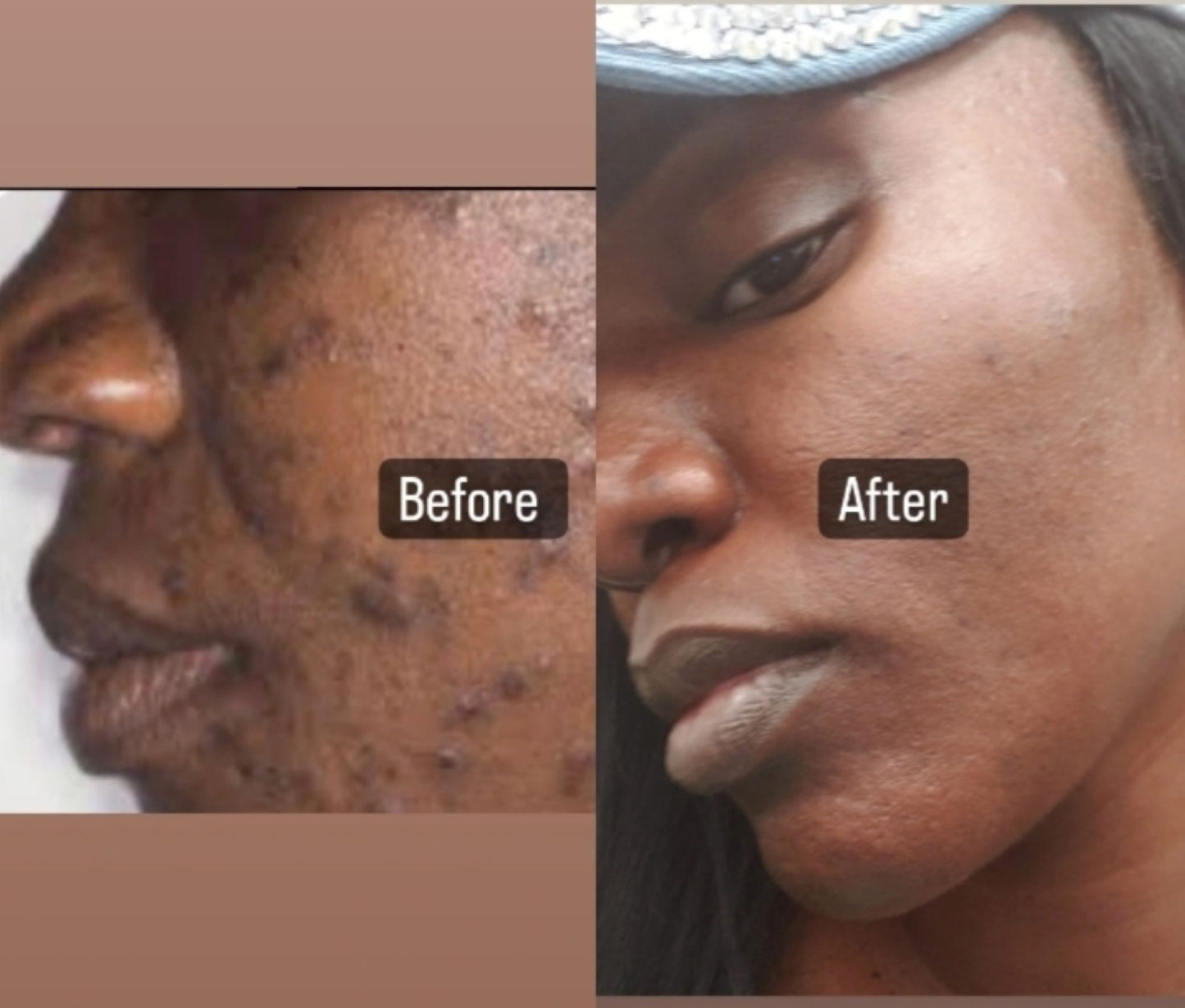 2 oz. Amazing Face Serum with Rose Water
