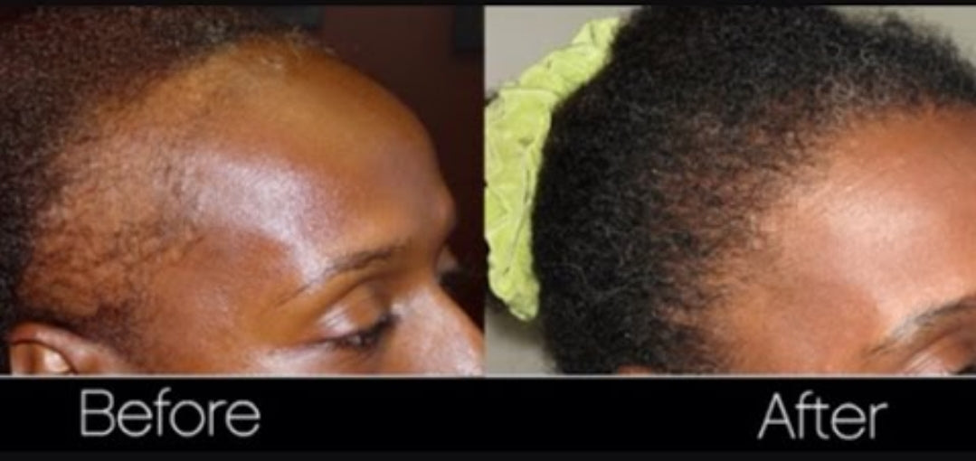 2 oz. Amazing hair growth drops with Jamaican Black Castor Oil