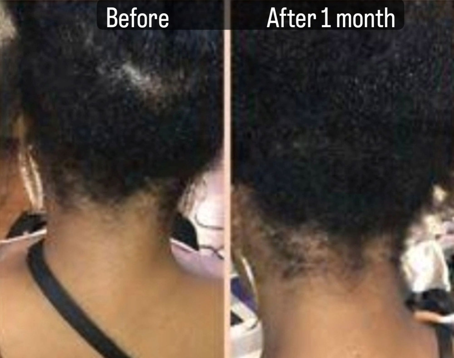 10 oz. Hair Growth Collection