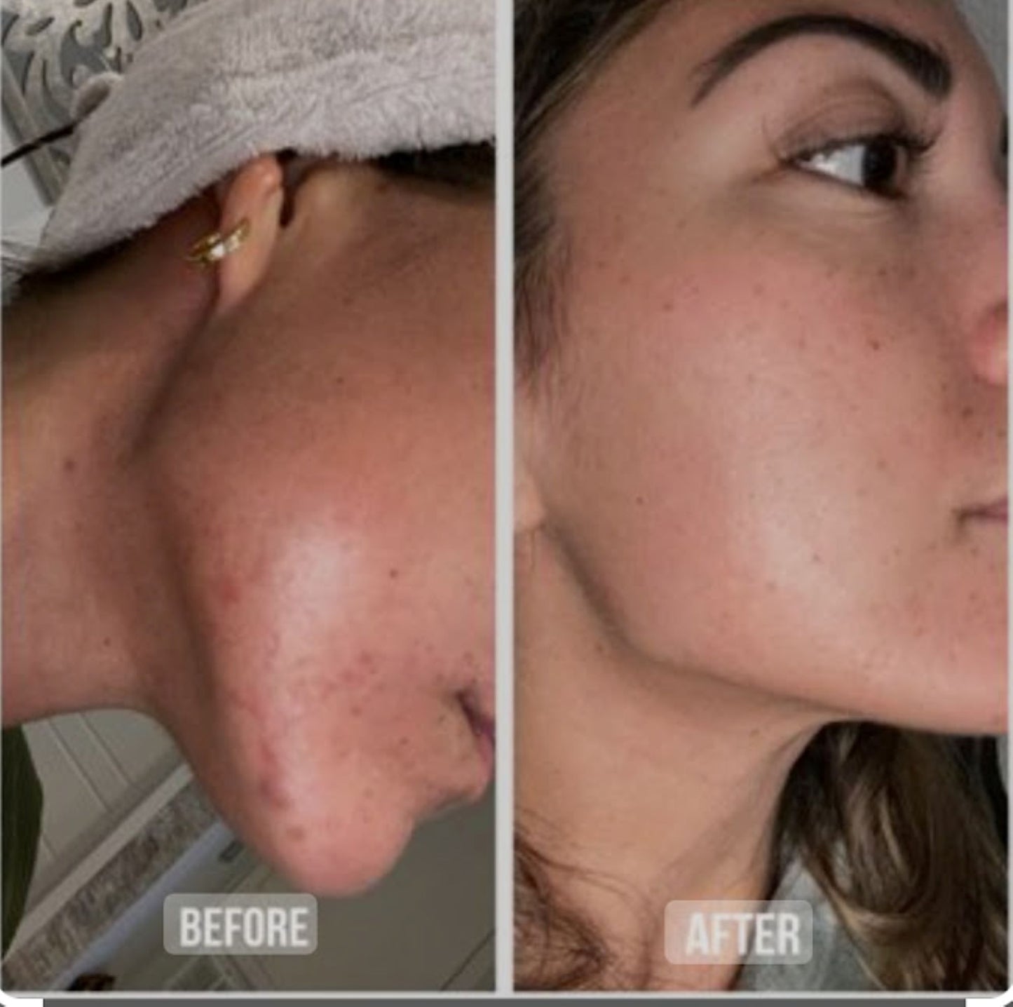 2 oz. Amazing Face Serum with Rose Water
