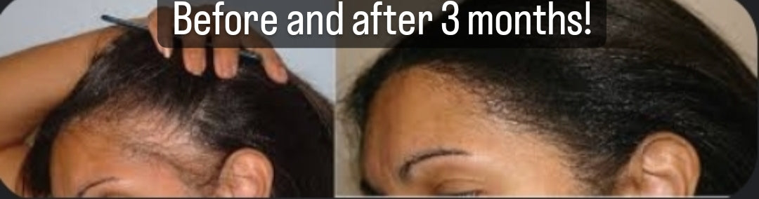 4 oz. Chebe Stimulating Hair Growth Oil.