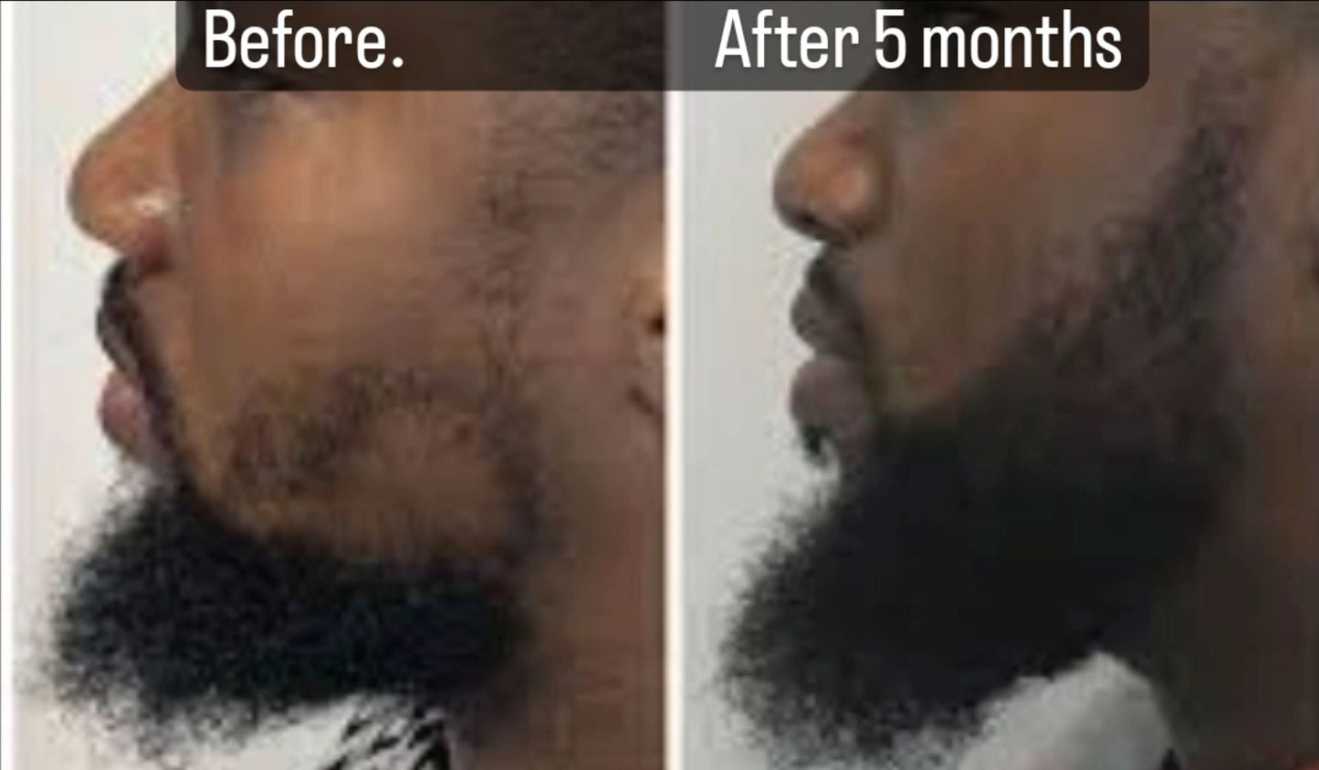 2 oz. Men Amazing beard Growth Drops