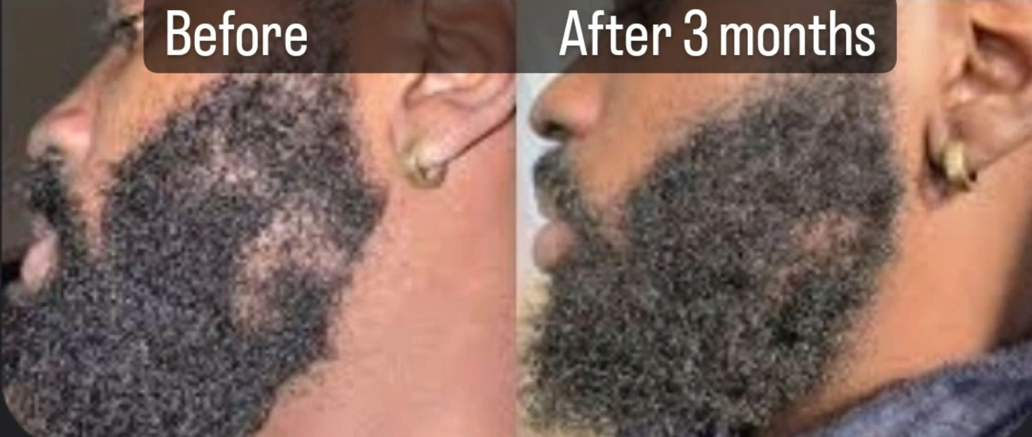 2 oz. Men Amazing beard Growth Drops