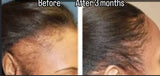 2 oz. Amazing hair growth drops with Jamaican Black Castor Oil
